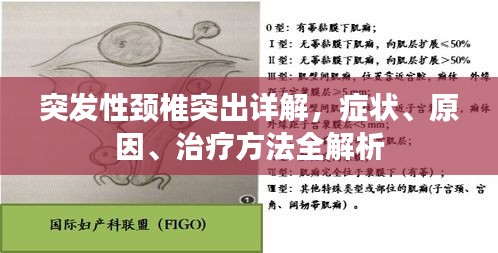 突發(fā)性頸椎突出詳解，癥狀、原因、治療方法全解析