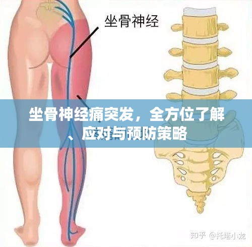 坐骨神經(jīng)痛突發(fā)，全方位了解、應(yīng)對與預(yù)防策略