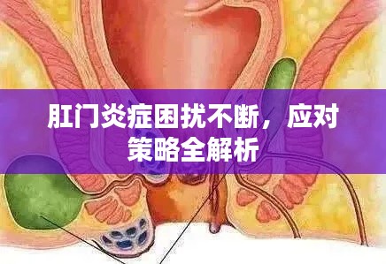 肛門炎癥困擾不斷，應(yīng)對(duì)策略全解析