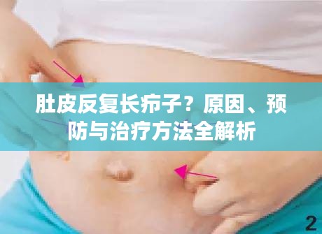 肚皮反復(fù)長(zhǎng)癤子？原因、預(yù)防與治療方法全解析