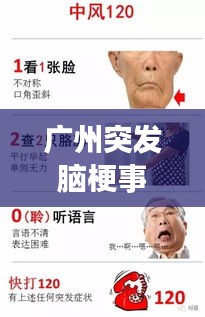 廣州突發(fā)腦梗事件，廣州看腦梗 