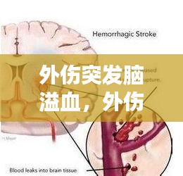 外傷突發(fā)腦溢血，外傷導致腦出血多久能恢復意識 