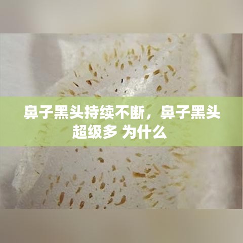 鼻子黑頭持續(xù)不斷，鼻子黑頭超級多 為什么 