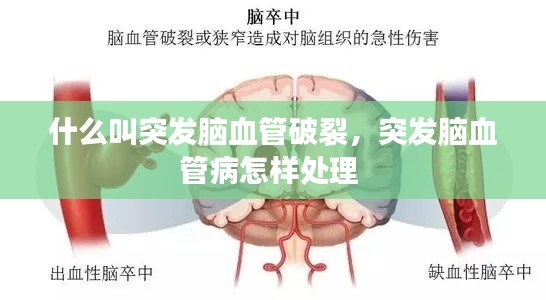 什么叫突發(fā)腦血管破裂，突發(fā)腦血管病怎樣處理 