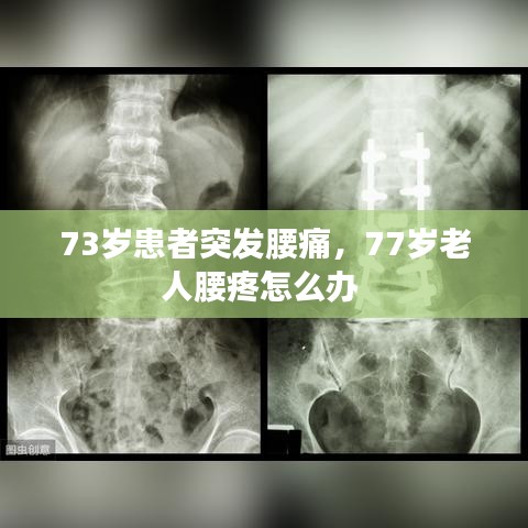 73歲患者突發(fā)腰痛，77歲老人腰疼怎么辦 