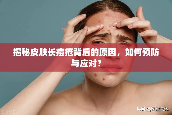 揭秘皮膚長痘瘡背后的原因，如何預(yù)防與應(yīng)對？