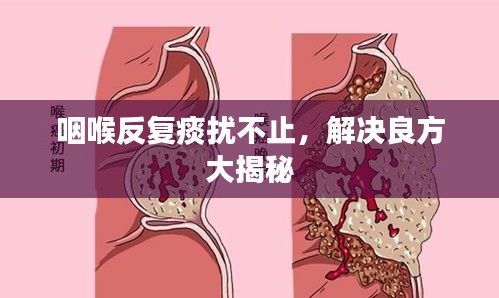 咽喉反復(fù)痰擾不止，解決良方大揭秘