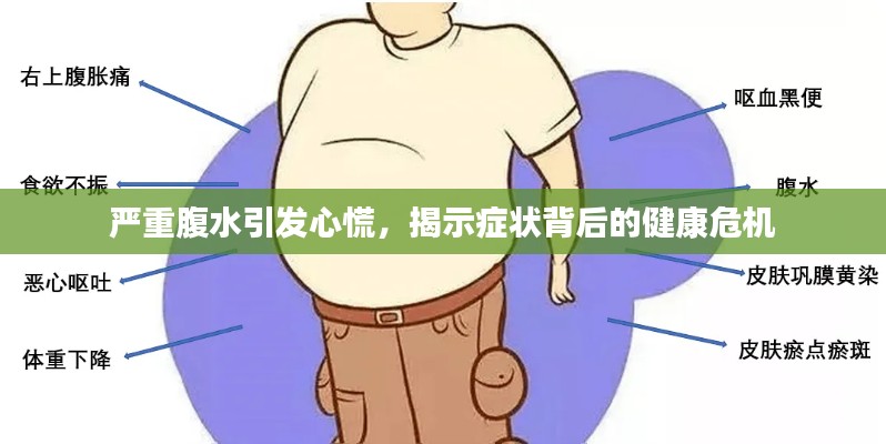 嚴(yán)重腹水引發(fā)心慌，揭示癥狀背后的健康危機